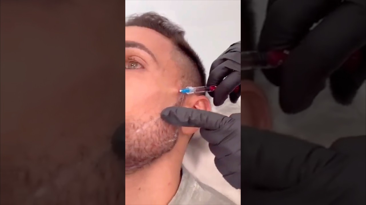 REAL MEWING TUTORIAL💀#real #mewing #tutorial #jawline #shelove